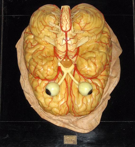 foto cervello con bulbi oculari